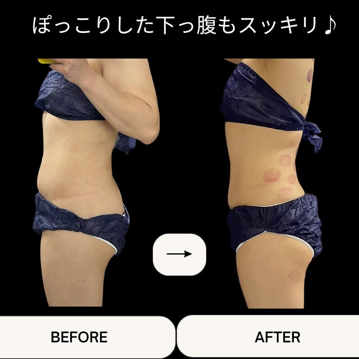 画像1356