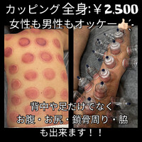 画像1430